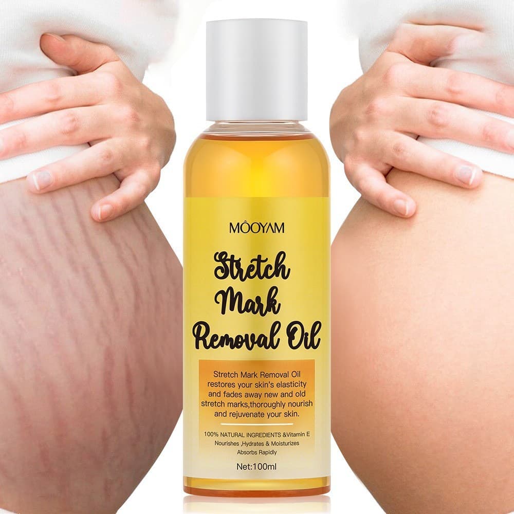 Stretch Mark Removal Oil, postpartum firming care oil, lightening body lines oil, body massage oil