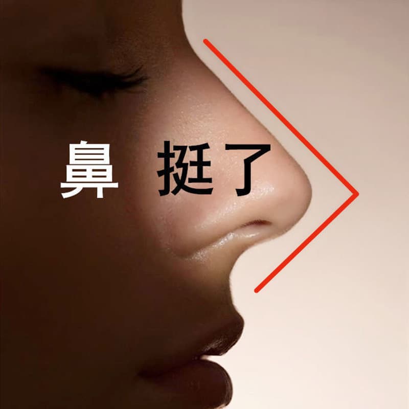 Baicao Shijia Student Nose Shaping Tool High Nose Bridge Root Lifting Nose Essential Oil Slim Nose Tip Flat and Low Nose Make Nose Straighter