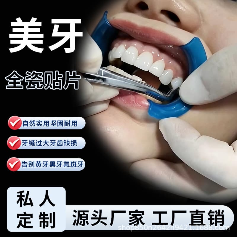 Ivoclar Full Porcelain Veneers, All-Porcelain Veneers, Blue Porcelain, Amber Porcelain, Lingxi Porcelain, Handmade Porcelain, Fluorosis Teeth Whitening