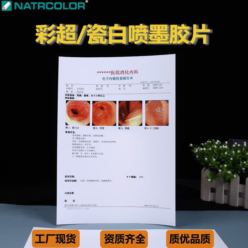Ophthalmology B-Scan Report Porcelain White Inkjet Film, PET Art Material, A4 Office Supplies, Printing Printer Strong Light Transparency