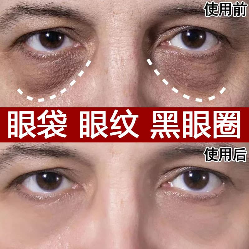 Lancome Pro-Xylane Pure Cream Eye Cream, Fade Dark Circles and Milia, Reduce Eye Bags and Fine Lines, Anti-Wrinkle Firming Eye Cream