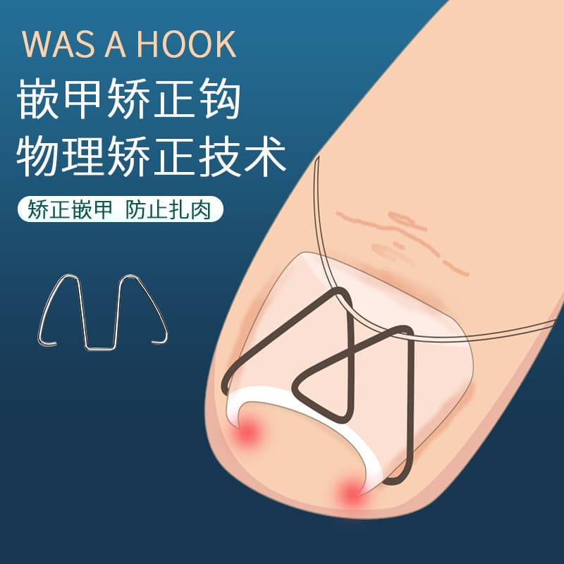Professional Nail Groove Correction Tool for Ingrown Nails Hook Fungus Nail Fixation Silicone Toe Corrector Pedicure Tool