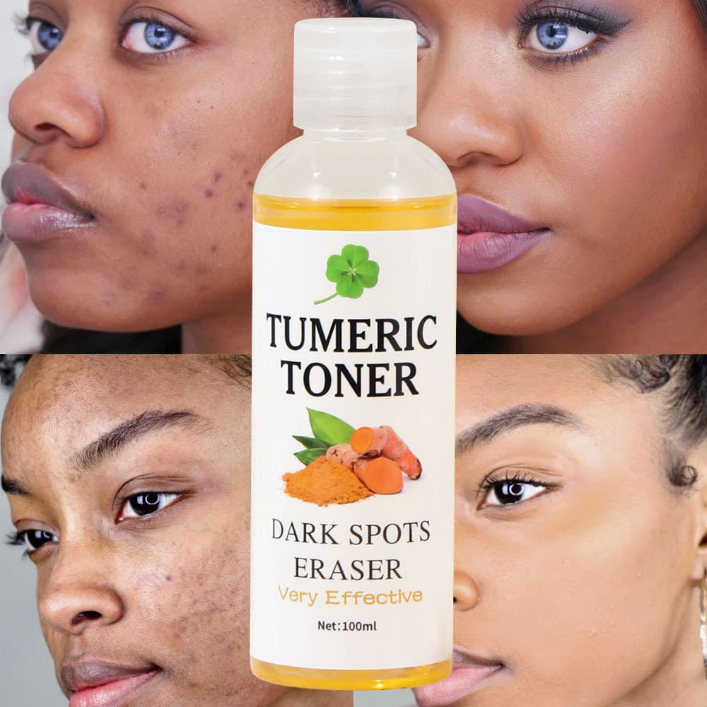 Turmeric Toner Softening Water, Spot Removal, Refreshing Skin Water, Beauty Care / Makeup / Cosmetic