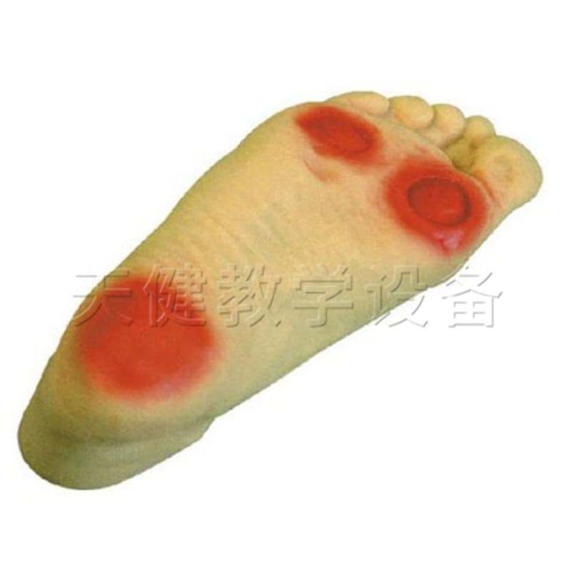 TJ/S19Ttang diabetic foot care modeltang diabetic foot lesion care model foot lesion demonstration