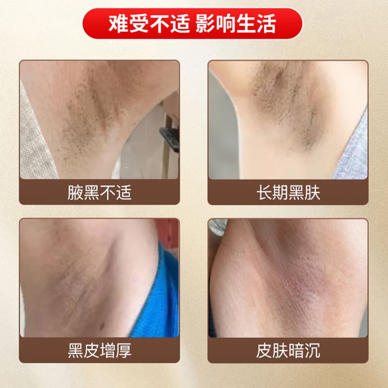 Dark Spot Removal Cream 50g - Underarm Skin Darkening and Discomfort - Melanin Removal Body Care Set