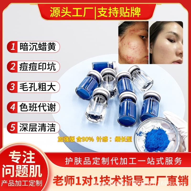 Blue Algae Sponge Microneedle Small Blue Mask, Long Bone Needle, Professional Use for Oil Control, Closed Comedones, Pigmentation, and Acne Scars