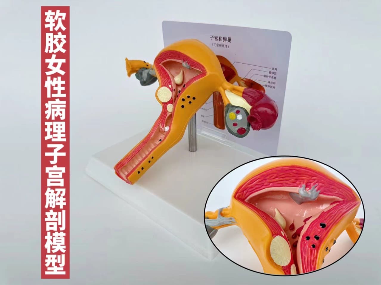 English female uterus model internal reproductive organ structure anatomy human body teaching pathology ovarian hospital school use