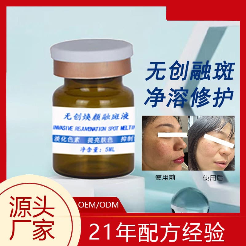 Beauty Salon Microneedle Non-Invasive Essence Spot Dissolving Liquid & Oil, Pigment Fading Treatment for Melasma, Skin Repair & Brightening