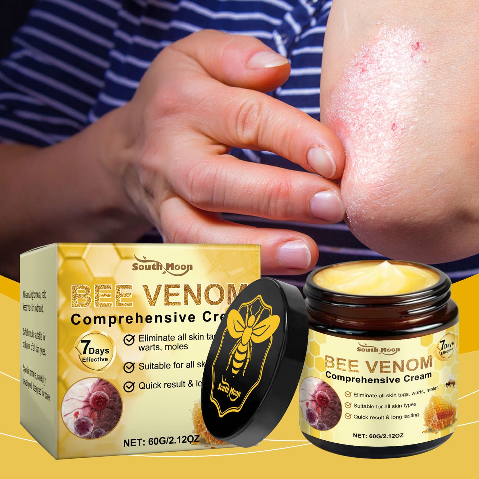 SOUTH MOON Bee Venom Skin Care Cream Gentle Nourishing Relief for Dry Skin Discomfort Body Care Cream