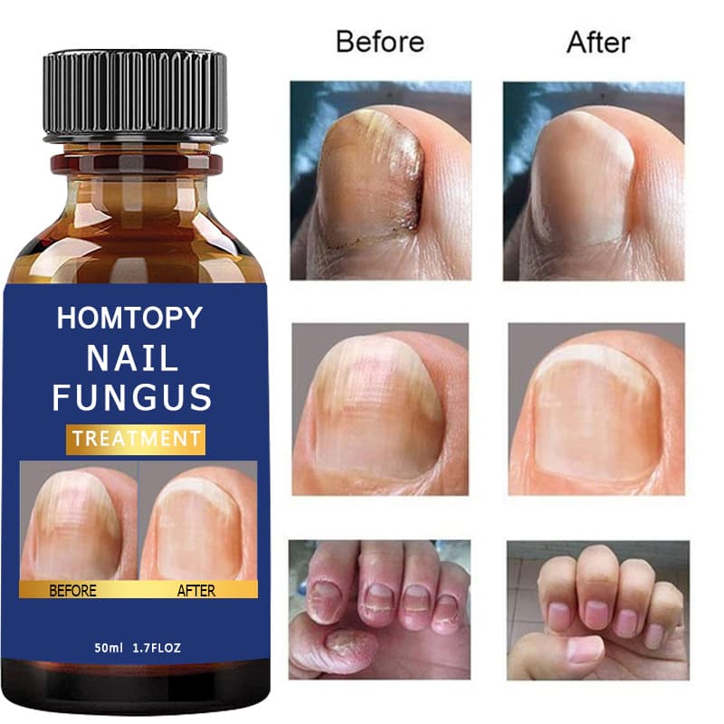 Cross-border new product onychomycosis liquid, repair and nourishing liquid, brightening nail essence, cleans and repairs nails.