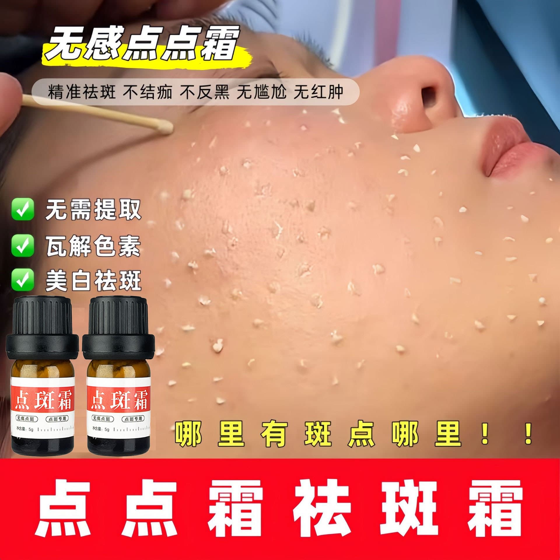 Salon-Exclusive Whitening and Freckle Removal Cream, Gentle Spot Blasting Cream, Decomposes Melanin, Removes Dermal Spots, Melasma, and Dot Spot Cream