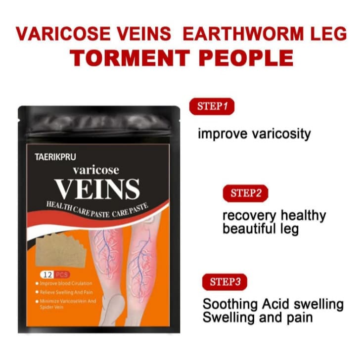 Cross-Border Vein Repair Patches for Varicose Vein Relief, Pain from Prominent Veins, and Varicose Repair