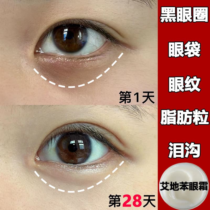 Anti-wrinkle firming anti-wrinkle eye cream to reduce fine lines, fat particles, tear troughs, eye bags and dark circles, moisturizing and anti-wrinkle eye cream