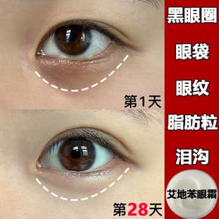 Eye Cream Anti-Wrinkle Firming Anti-Wrinkle Reduce Fine Lines Milia Tear Trough Eye Bags Dark Circles Moisturizing Nourishing Wrinkle Eye Cream