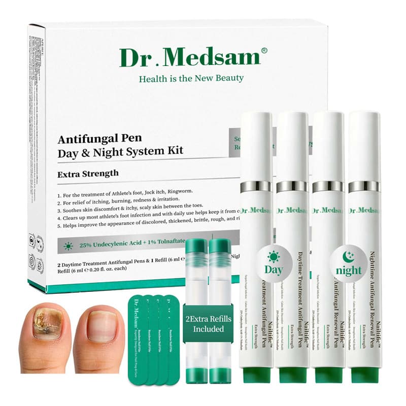 1% Tolnaftate Antifungal Nail Pen with Undecylenic Acid for Repairing Onychomycosis, Athlete's Foot, and Toenail Fungus Antifungal Pen