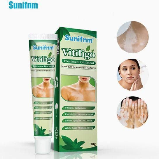 Sunifnm Cross-Border White Spot Cream Amazon Skin Care Cream Gentle Soothing White Spot Care and Health Care Cream