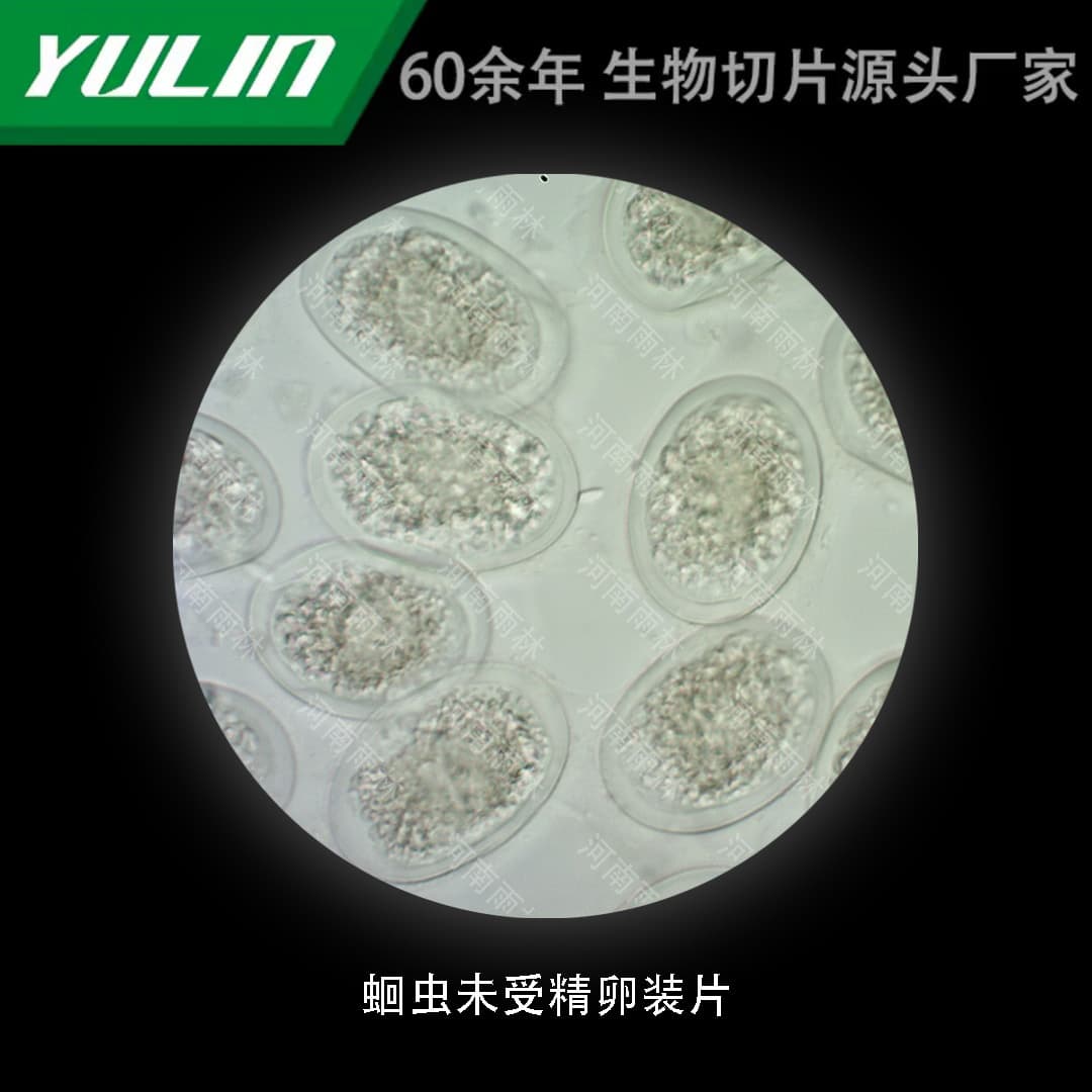 Unfertilized Ascaris Egg Slide, Histopathology Paraffin Section Specimen for Medical College Microscopy