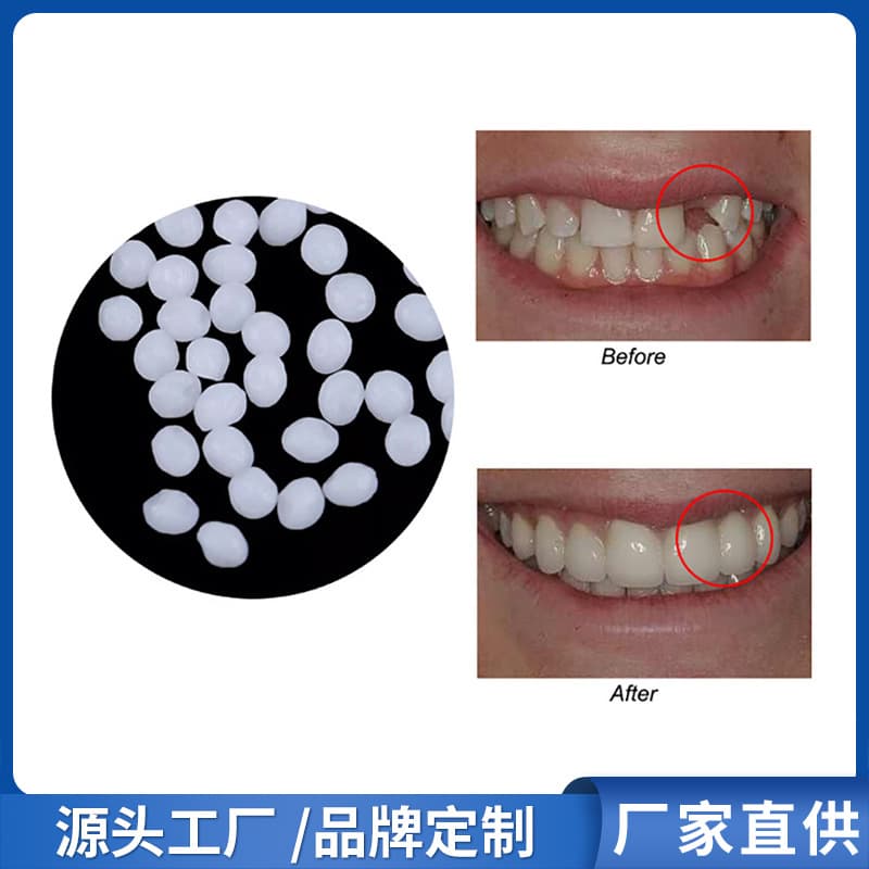 Manufacturer wholesale solid teething gel for film, television, makeup, dentures, temporary fillings, cavities, gaps, and teeth filling.