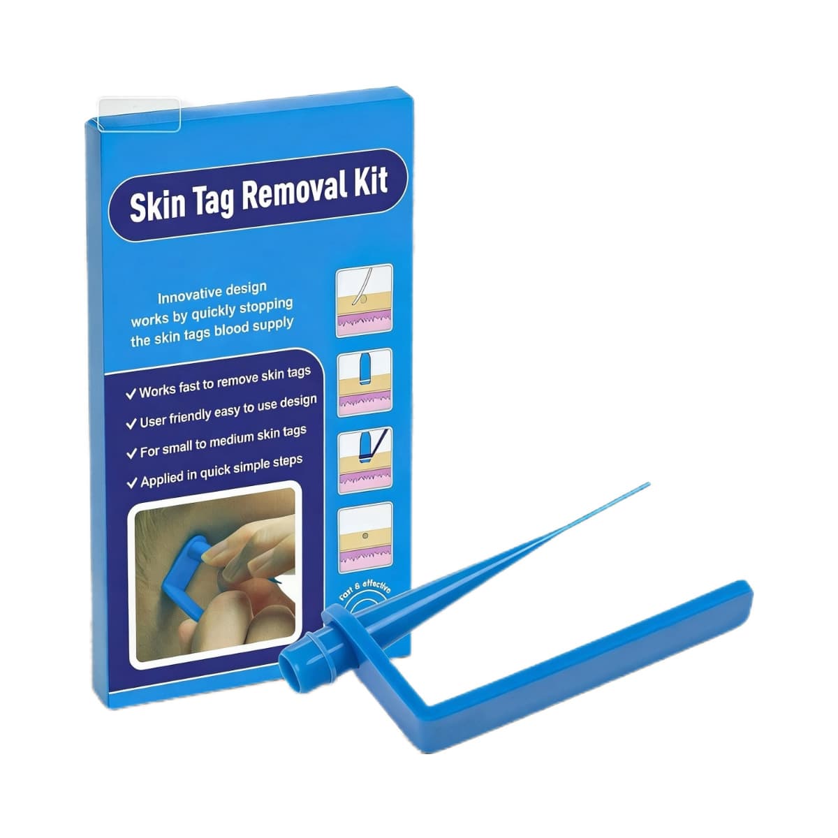 Wart Removal Pen, Wart Removal Tool, Skin Tag & Mole & Wart Remover 2-in-1 Skin Tag Removal Tool