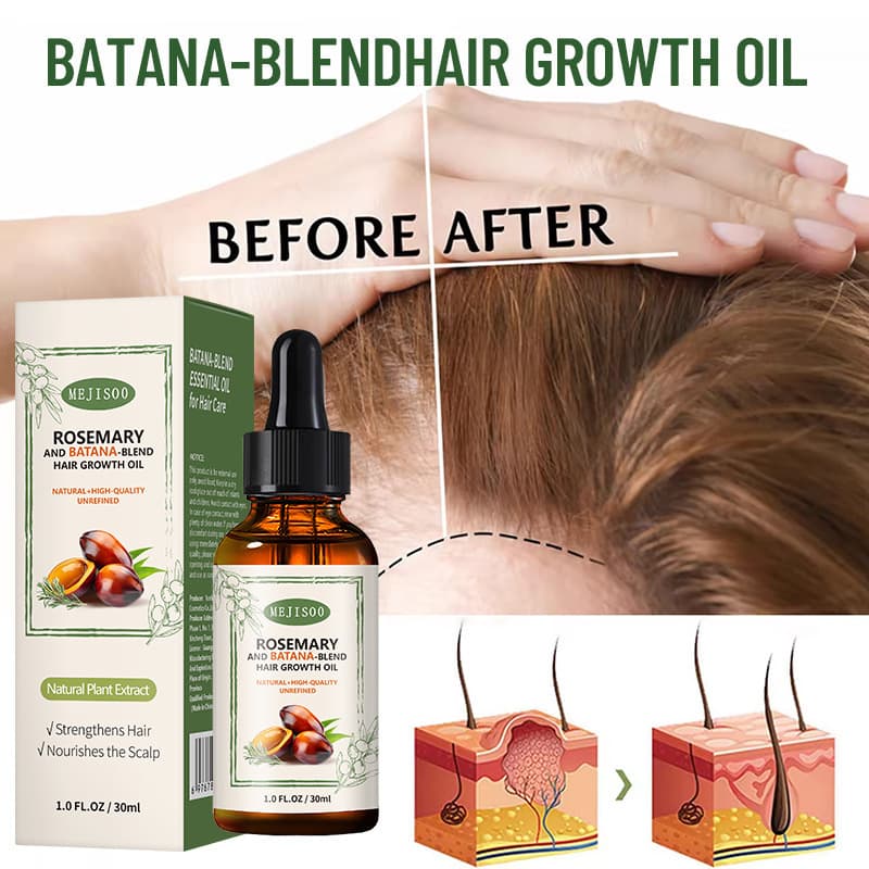 ROSEMARY BATANABLEND HAIR GROWTH OIL Bataná Hair Care Oil