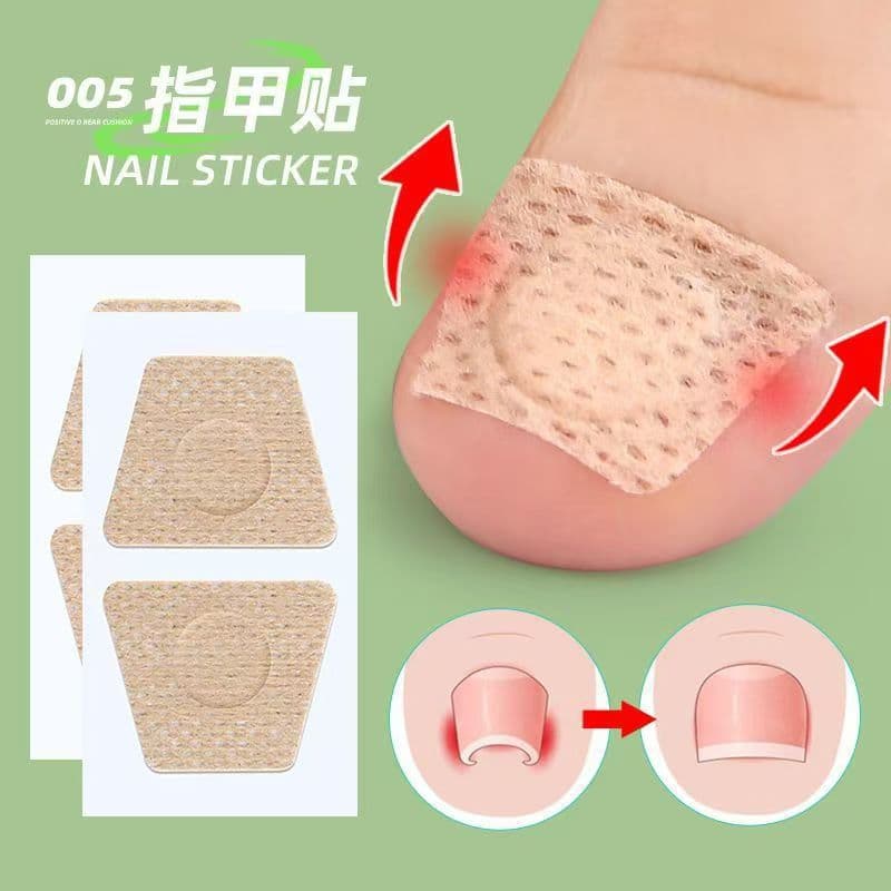 Factory-made nail care patches, toe pads, orthopedic patches, nail grafting patches, soft nail repair patches, and straightening patches.