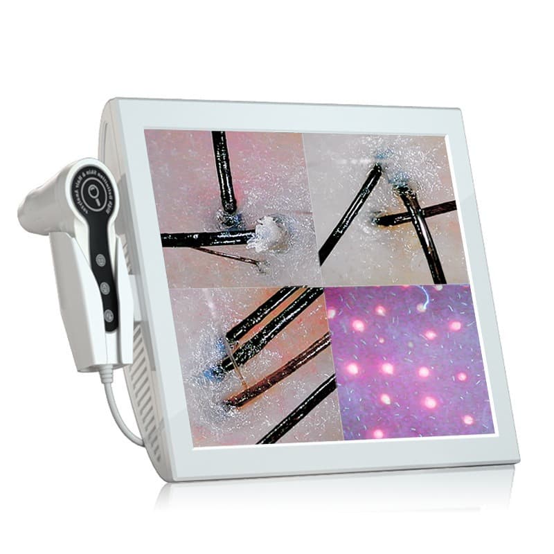 15-Inch Scalp Analyzer Hair Follicle HD Panel All-in-One Desktop Intelligent Facial Skin Analysis Device