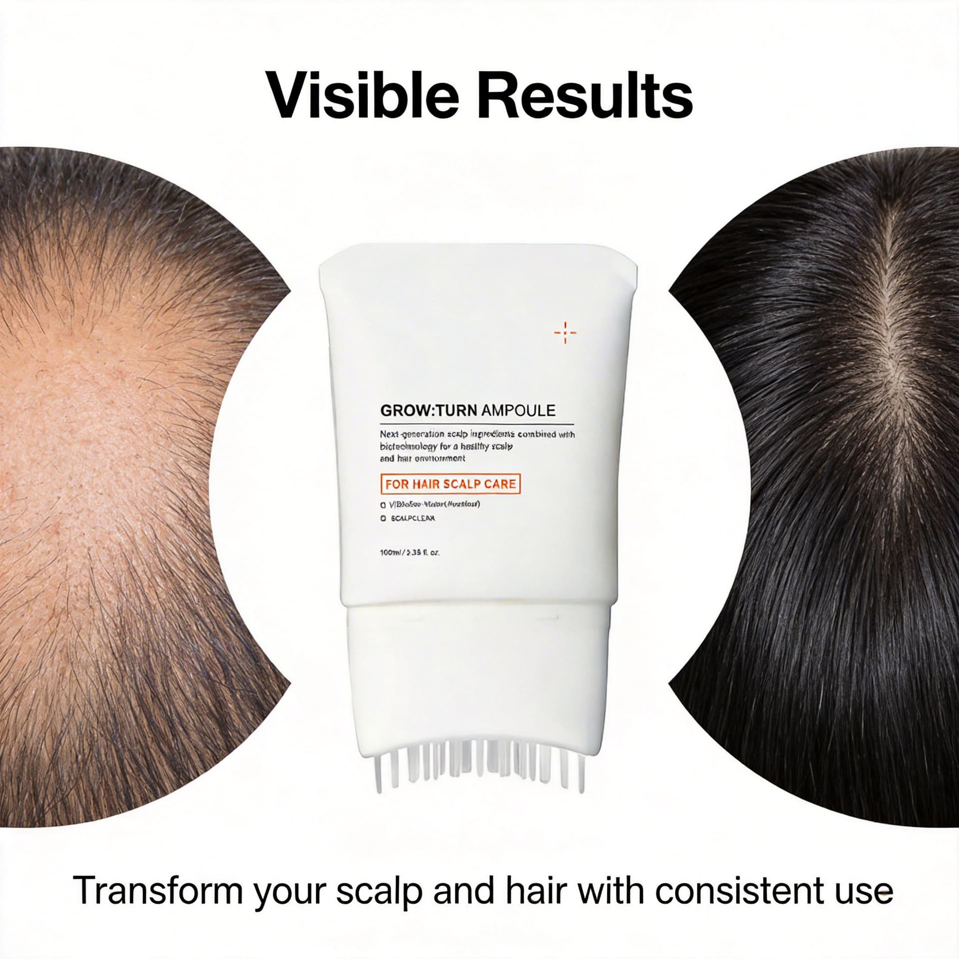 Cross-border Stock Hair Growth Serum with Built-in Brush Head for Massage and Hair Thickening