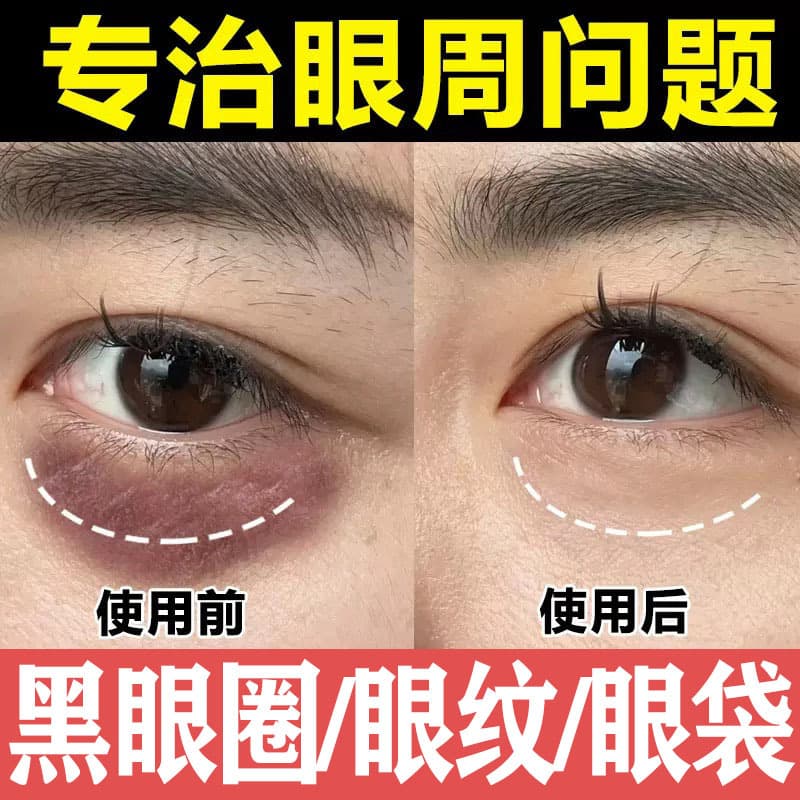 Anti-wrinkle eye cream, genuine fine lines, eye bags and dark circles, improvement of fine lines, fat particles, eye care, ultrasonic scalpel eye cream