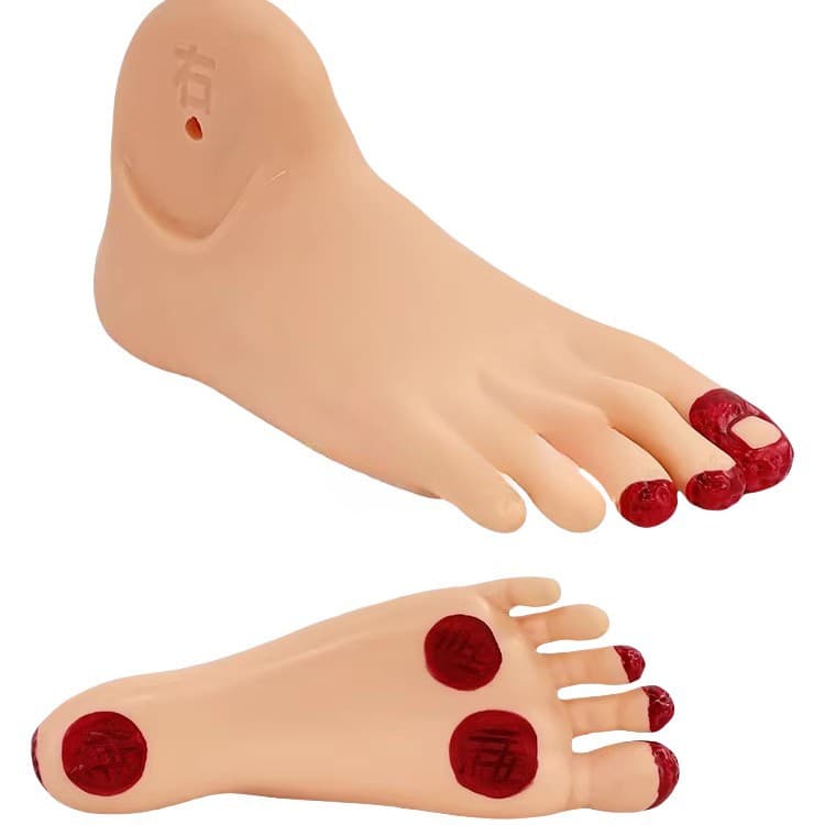 Diabetes/diabetes foot care model Diabetes/diabetes patients foot lesions model Foot pathological changes foot model