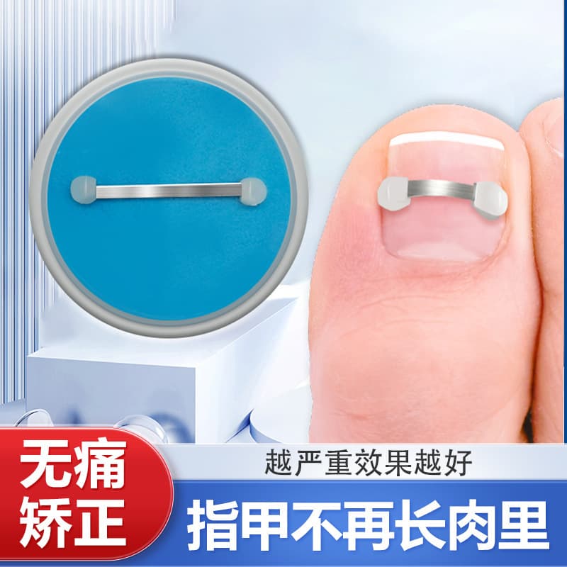 Nickel-Titanium Alloy Orthopedic Nail Corrector for Ingrown Toenails, Bionic Bone Spring Wire, Toenail Fingernail Embedding, Inflammation, Nail Art