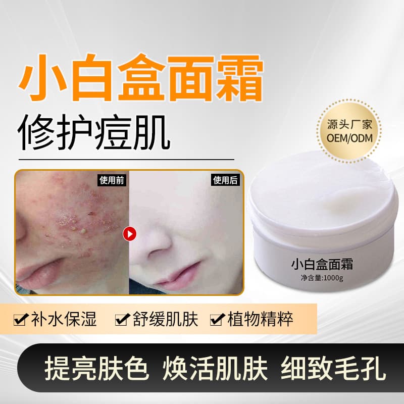 Hainan moonlight small white box cream removes acne, removes blackheads, brightens skin, repairs and shrinks pores, removes acne cream, removes acne cream