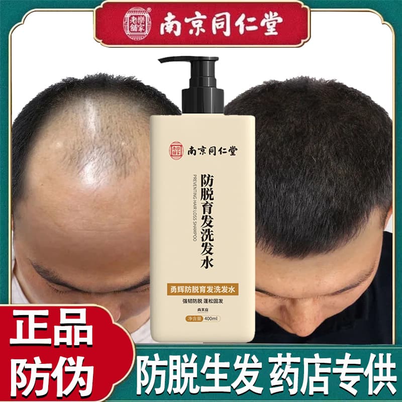 Nanjing Tongrentang Ginger Shampoo Anti-Hair Loss Hair Growth Serum for Baldness Hairline Thickening Dandruff Removal Genuine