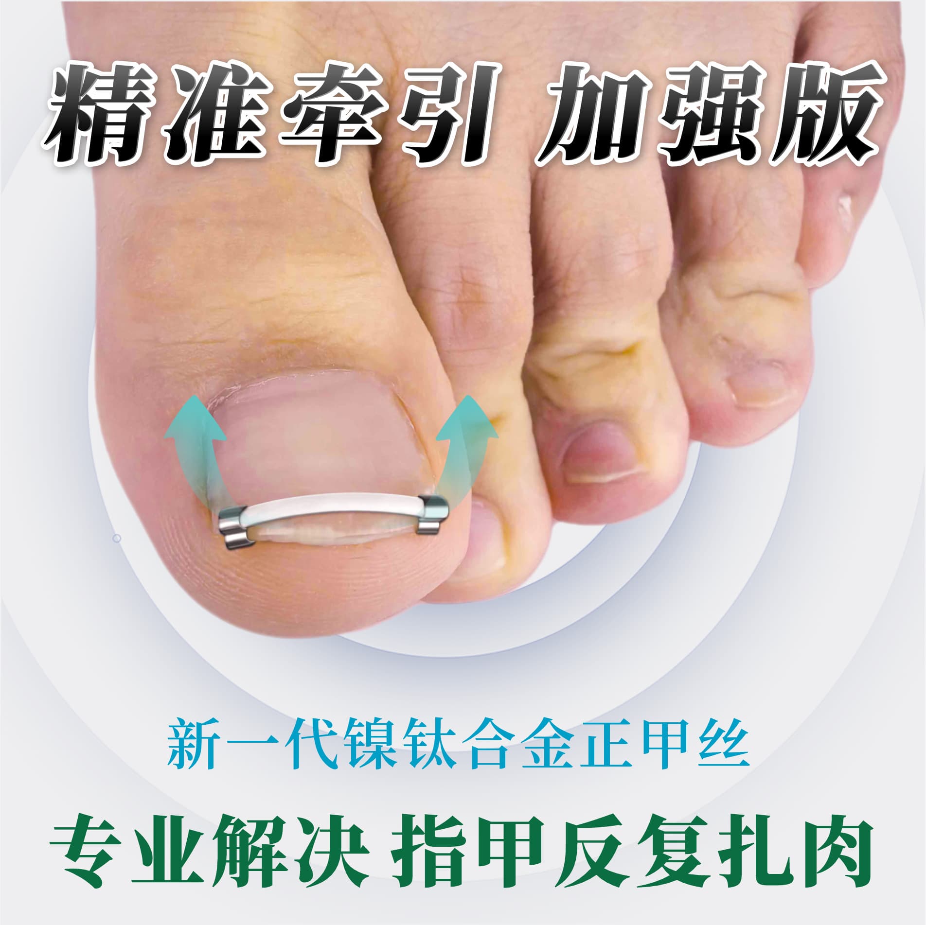 Nail Correction Patch, Nitinol Alloy, Curved Nail Lifting Patch, Reverse Pull Ingrown Nail Hook, Nail Correction Clip for Toenail Groove Correction