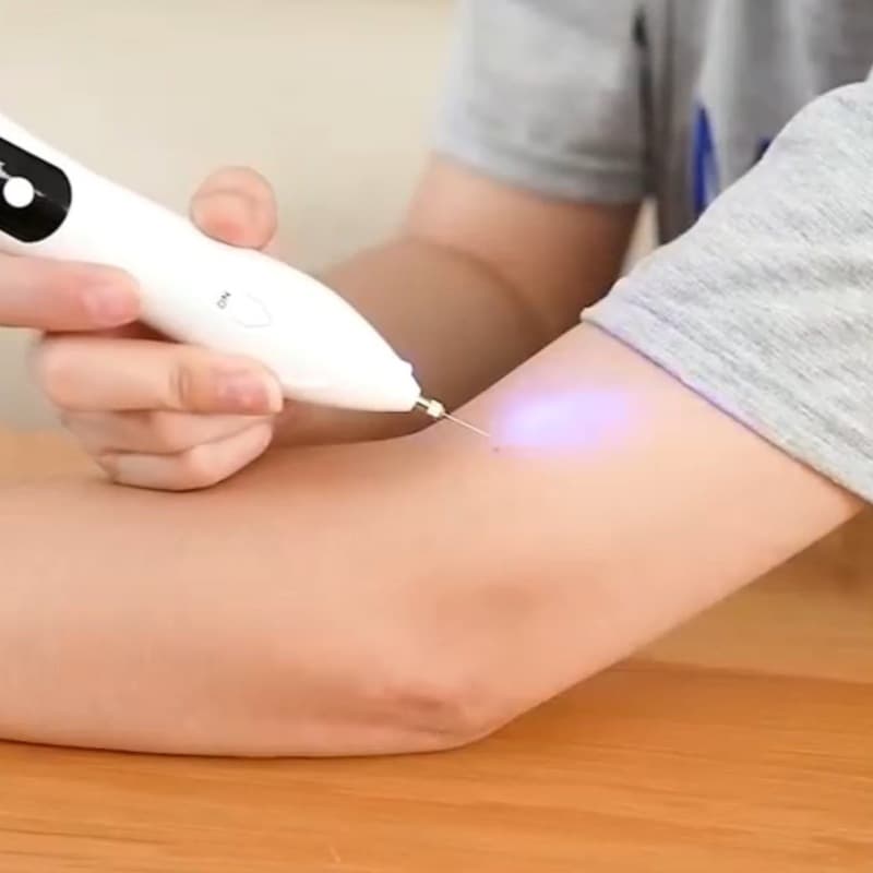 Small white mole removal pen, spot removal pen, electric beauty spot pen, LCD micro-laser facial beauty device