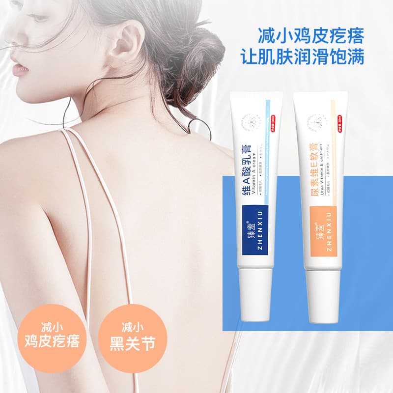 Zhenshi vitamin A acid cream exfoliating urea vitamin E cream removes chicken skin melanin removes blackheads and removes acne ointment wholesale