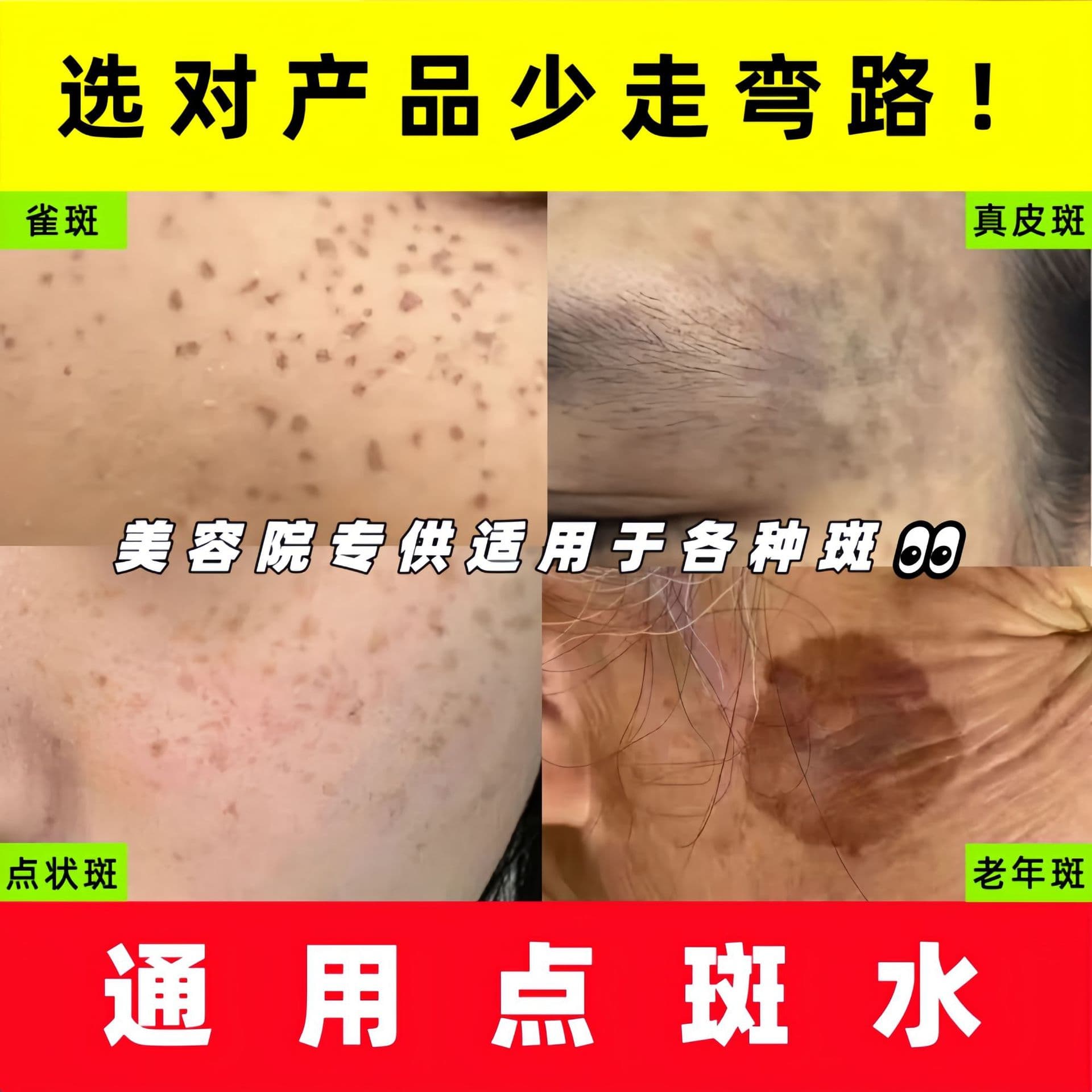 General Spot Removal Liquid Freckle Extract Pigment Decomposition Liquid Mole Removal Bio-Enzyme Professional Salon Supply