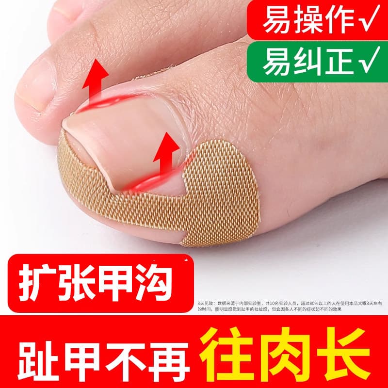 Nail Repair Pull-Up Patch, No Glue Required, Quick Toenail Deformity Correction Patch, Anti-Ingrown Toenail Adhesive Patch