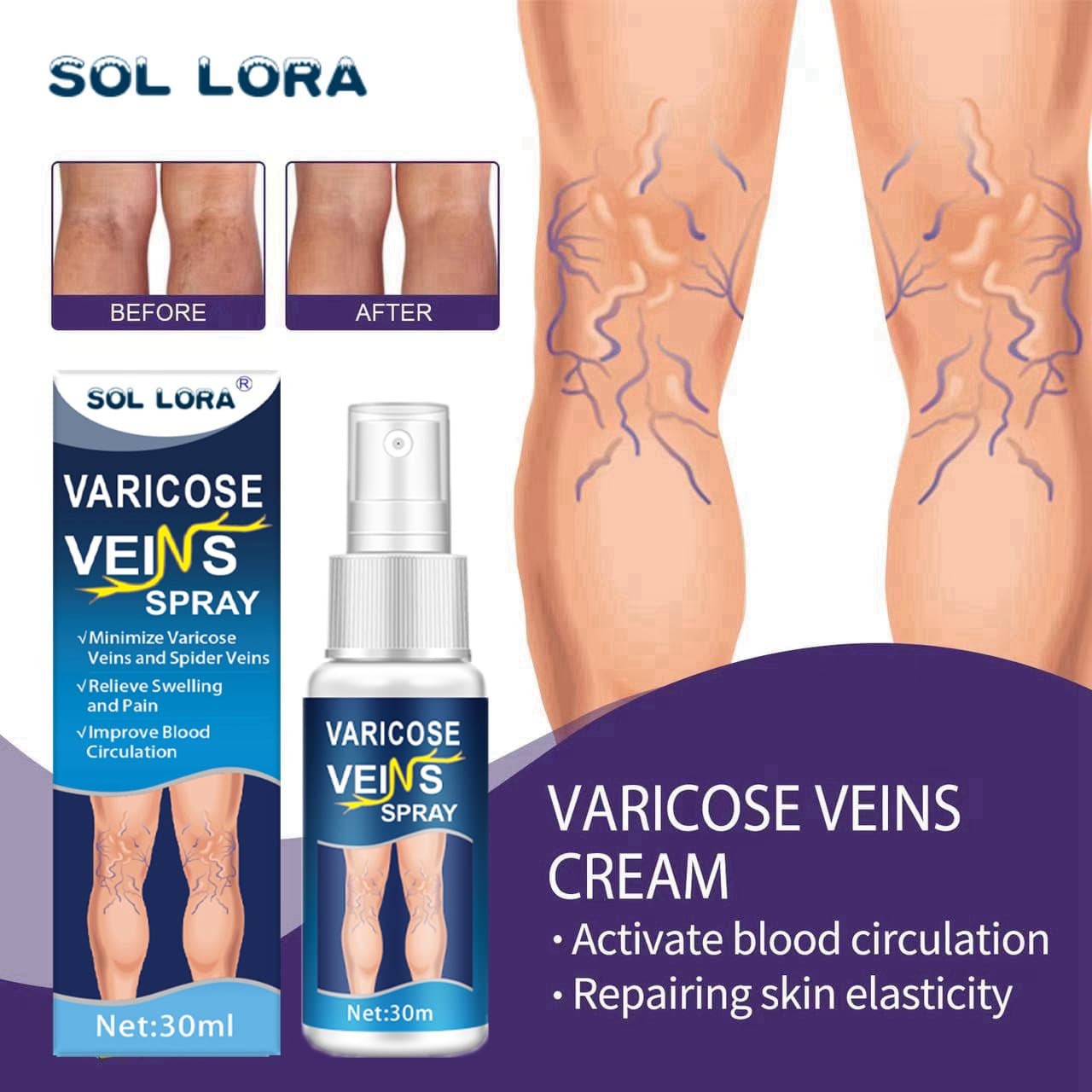 SOL LORA Varicose Vein Massage Spray Smooths Protruding Blood Vessels Skin Care Relieves Varicose Veins Spray