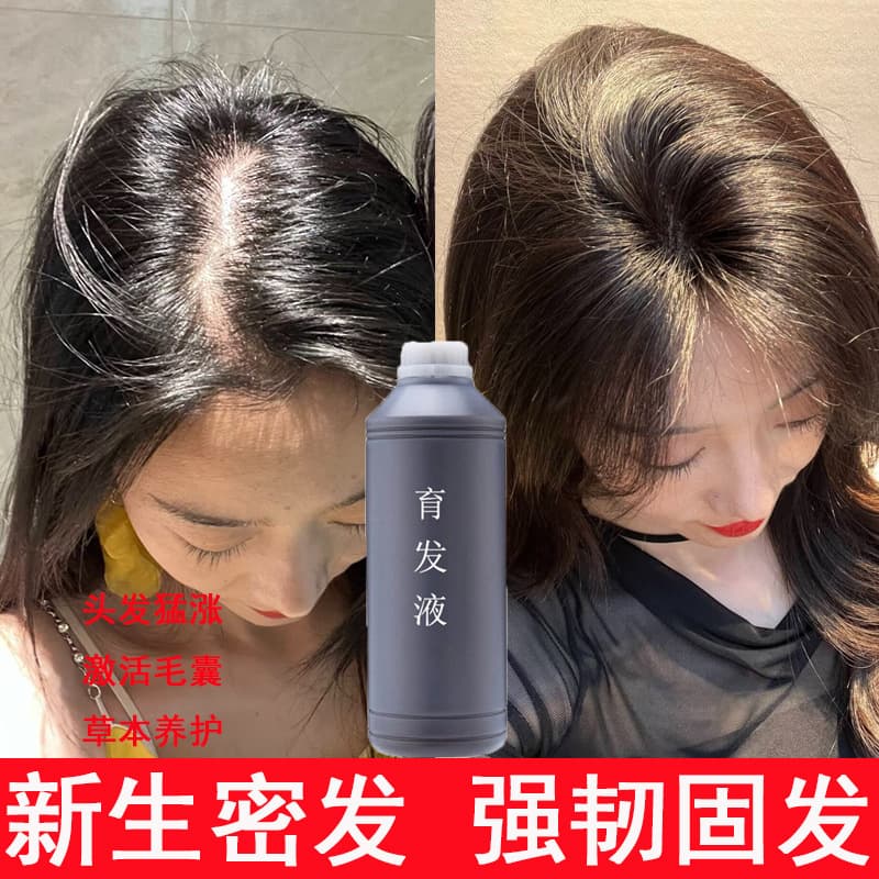 Anti-Hair Loss Serum Hair Growth Essence Hairline Growth Activates Hair Follicles Arborvitae Hair Tonic