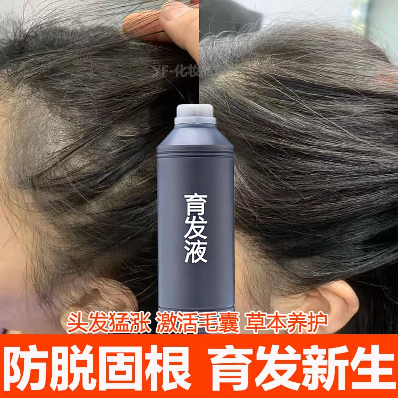 Anti-Hair Loss Serum Hair Growth Essence Hairline Growth Activates Hair Follicles Arborvitae Hair Tonic