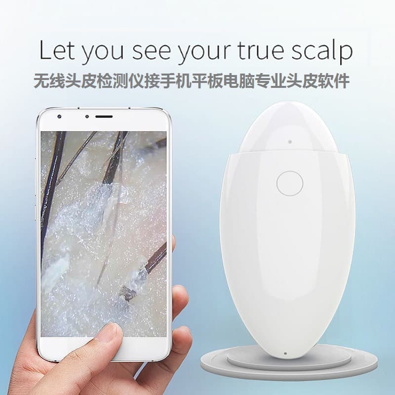 Manufacturer Supports Cross-Border Supply Source Scalp Detector HD 500X Magnification Wireless Connection to Mobile/Tablet for Follicle Analysis
