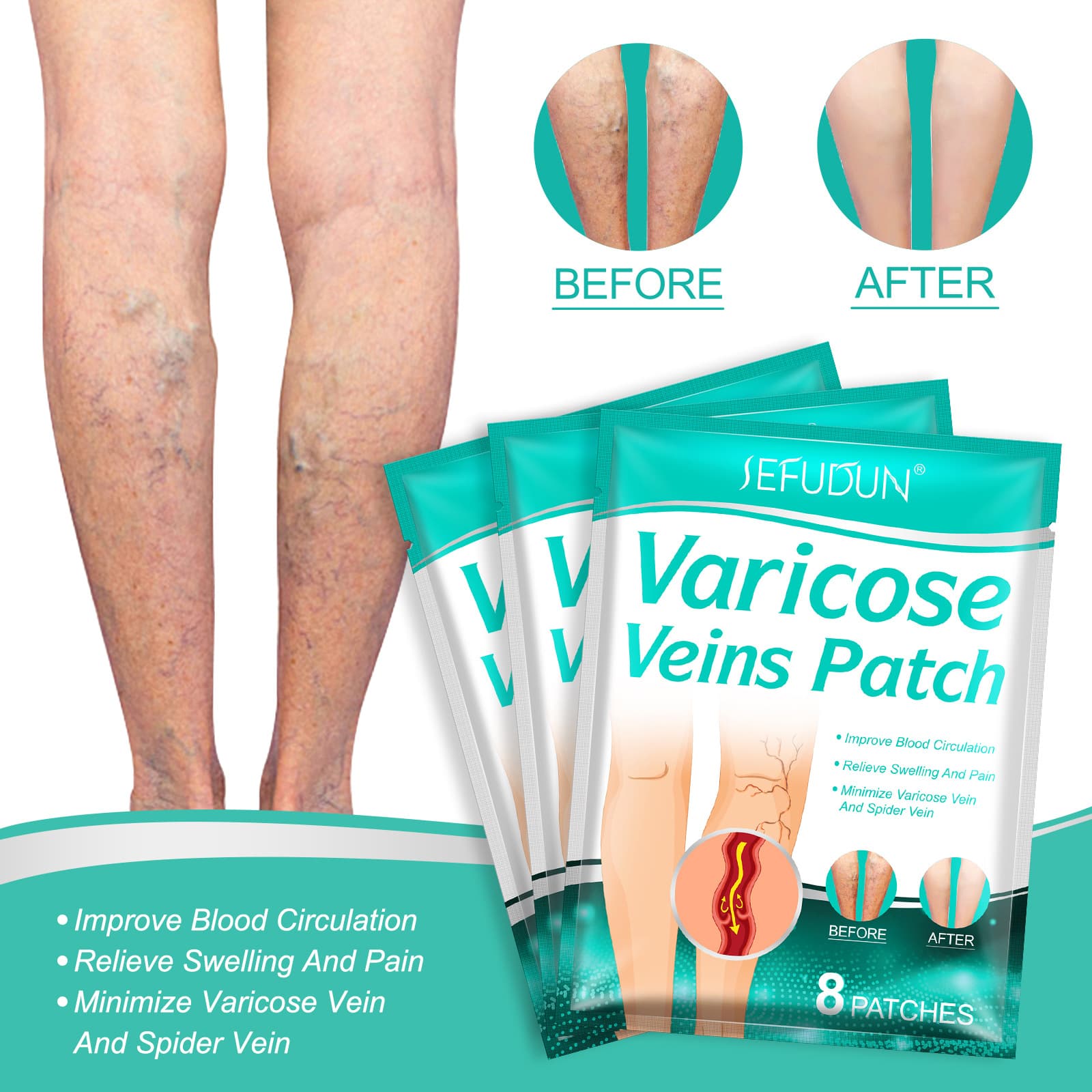 Cross-border SEFUDUN Vein Patch 8 Patches