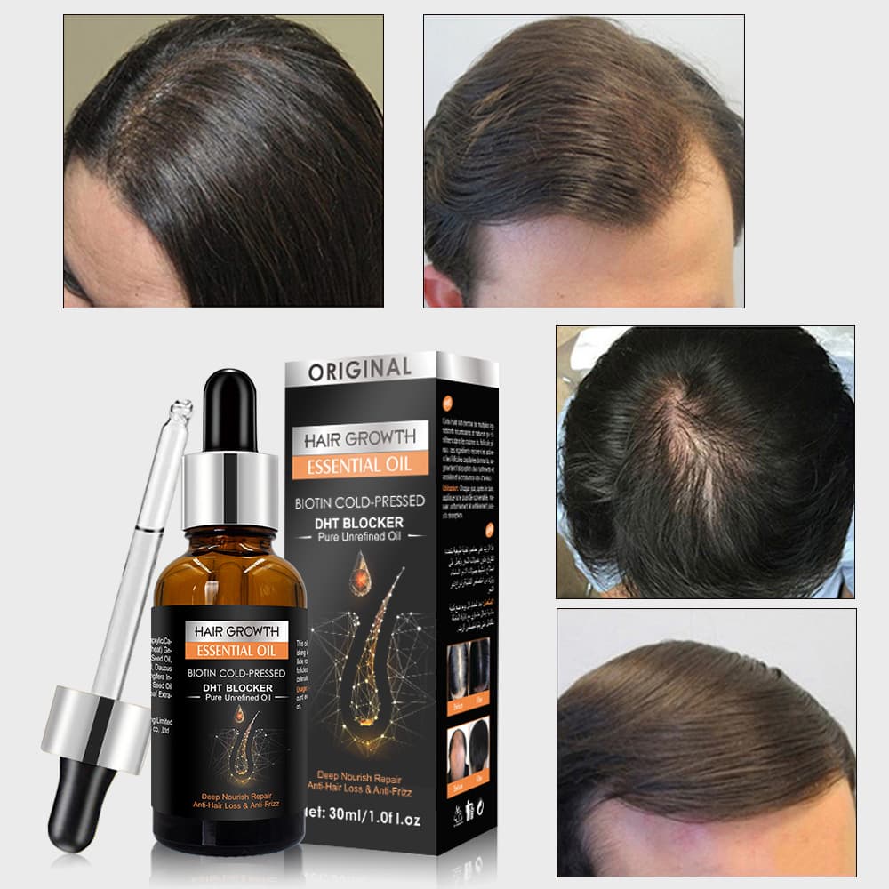 Cross-border ginger hair essential oil scalp care leave-in hair care massage essential oil wholesale Hair growth oil