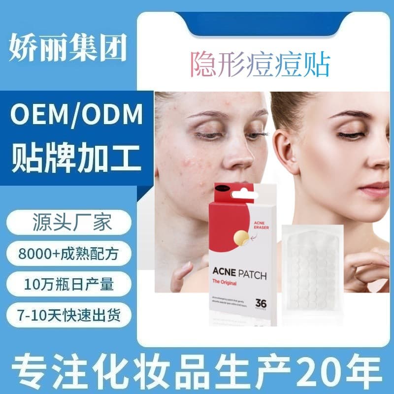 Cross-border OEM best-selling transparent acne patches, invisible hydrocolloid facial acne and whitehead removal tablets, waterproof acne treatment.