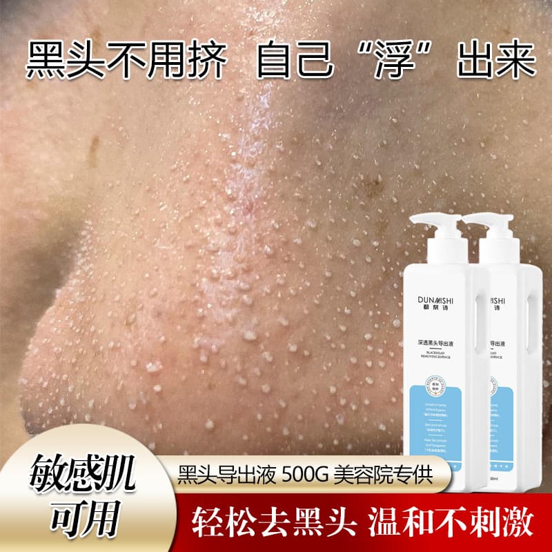 Salon-Supply Blackhead Removal Deep Cleansing Pore Minimizing Bubble Treatment Gentle Fruit Acid T-Zone Extraction Solution