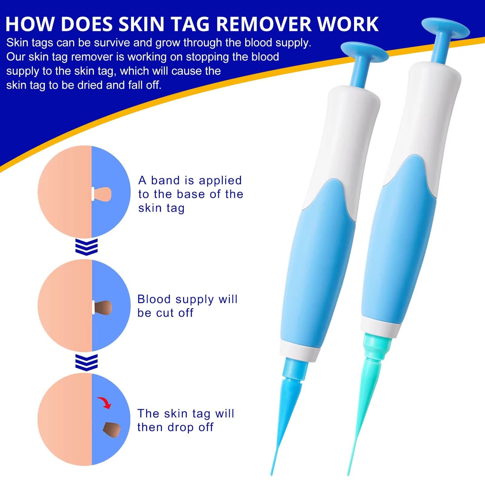 Skin Tag Removal Tool - Skin Tag Remover Pen for Moles, Corns, and Warts - Home Manual Wart Remover