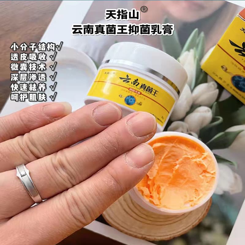 Yunnan Tianzhishan Fungus King Anti-Itch Cream Herbal Remedy Cream Antibacterial Peeling Cream Topical Cream 25g/Bottle