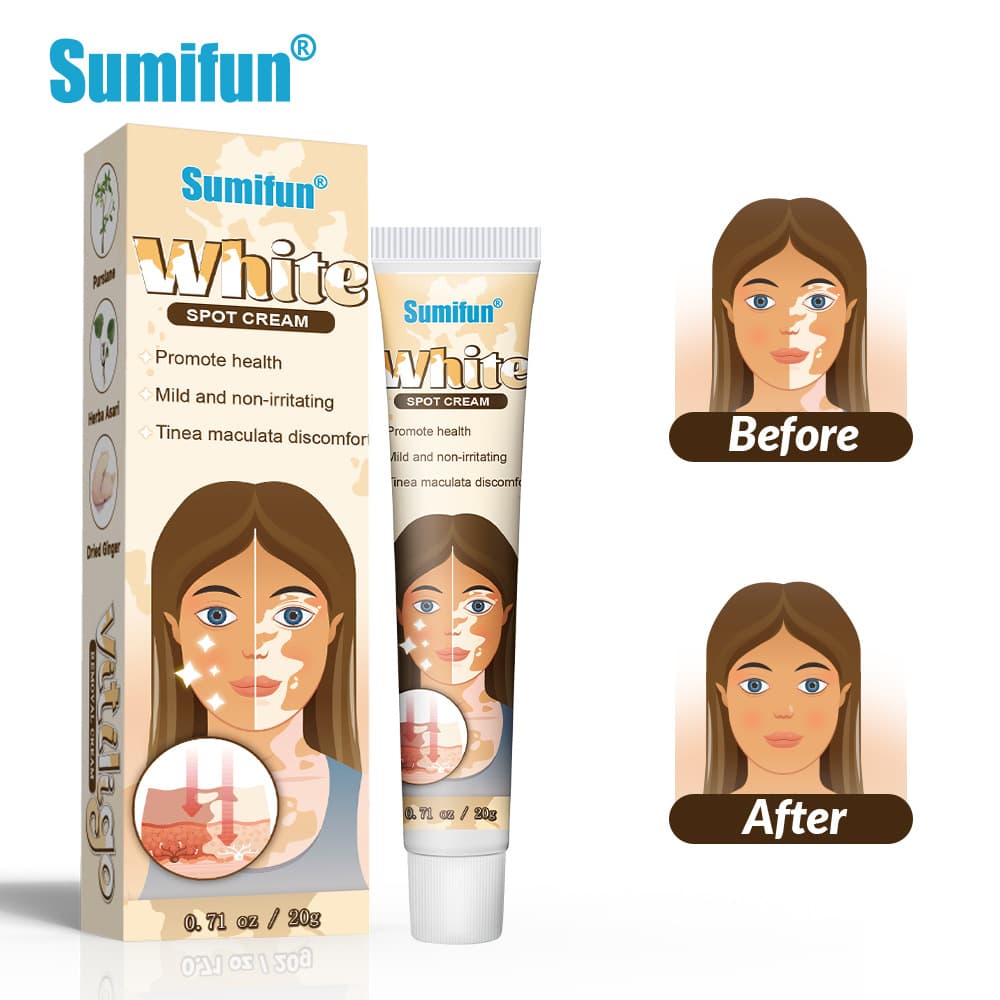 Sumifun Cross-border Ointment White Spot Soothing Cream White Spot Clean Repair White Spot Tinea Versicolor Care Ointment DZ1007302