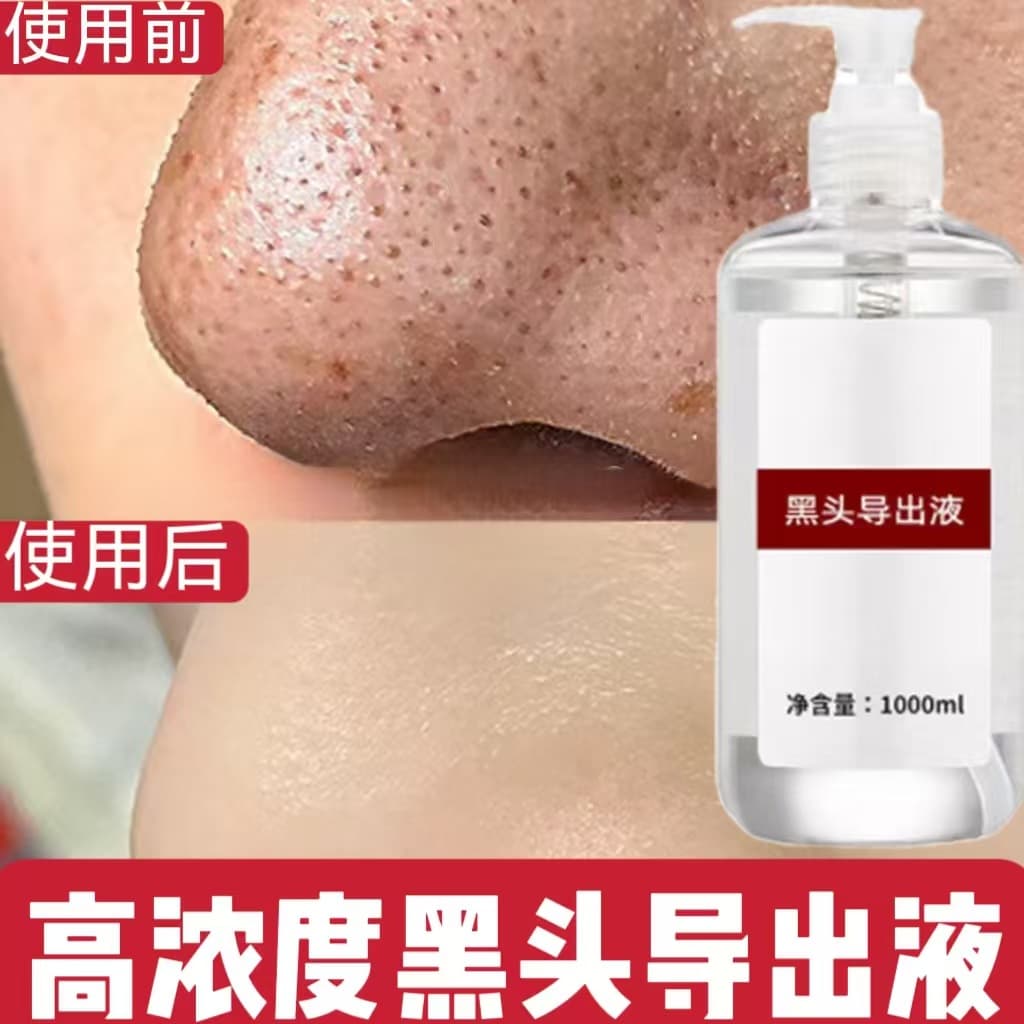 Blackhead exporting liquid to remove blackheads and whiteheads and shrink pores. Beauty salon uses gentle small bubble blackhead exporting liquid.