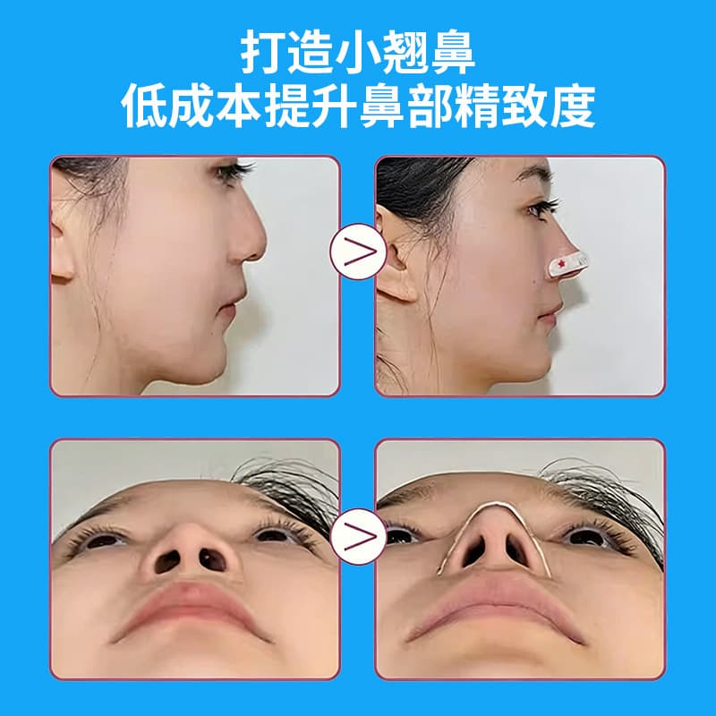 Adjustable Memory Wire Nose Shaping Patch, Cartoon Nose Lifter for Nose Bridge Correction and Nose Wing Slimming